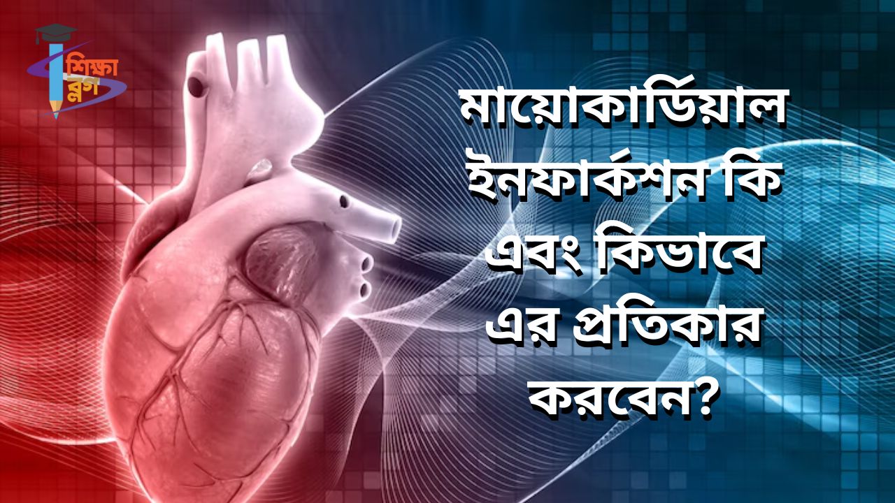 মায়োকার্ডিয়াল ইনফার্কশন কি