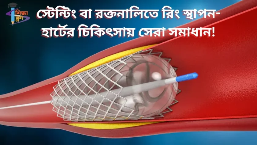 স্টেন্টিং বা রক্তনালিতে রিং স্থাপন