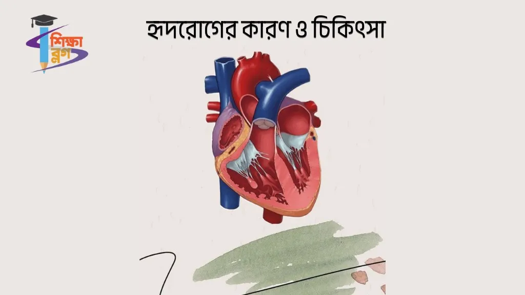 হৃদরোগের কারণ ও চিকিৎসা- Heart disease